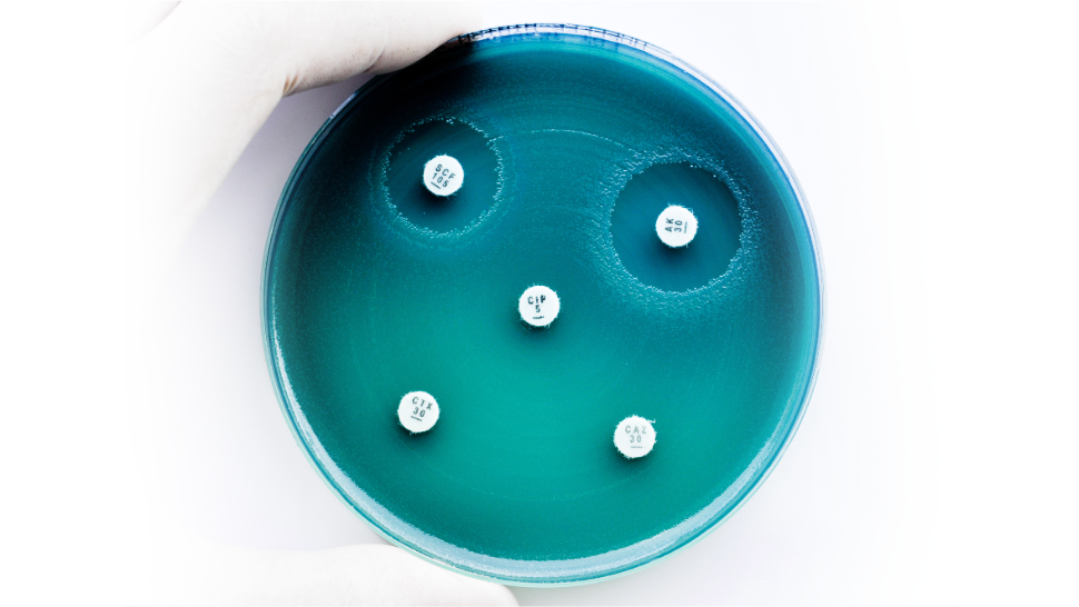 Placas blog Pseudomonas aeruginosa