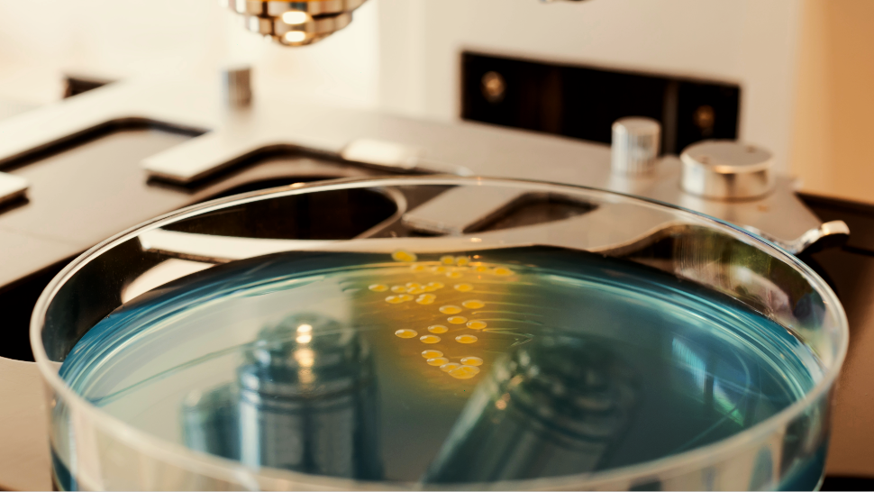 Campylobacter in local poultry: why vigilance matters Campylobacter in local poultry: why vigilance matters