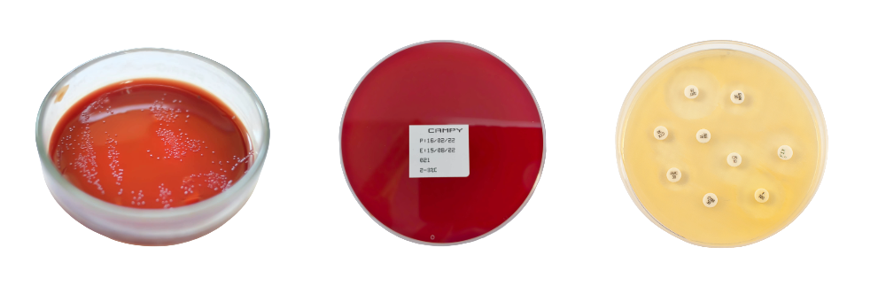 (Asiagel) Imagen dentro blog medios cultivo campylobacter